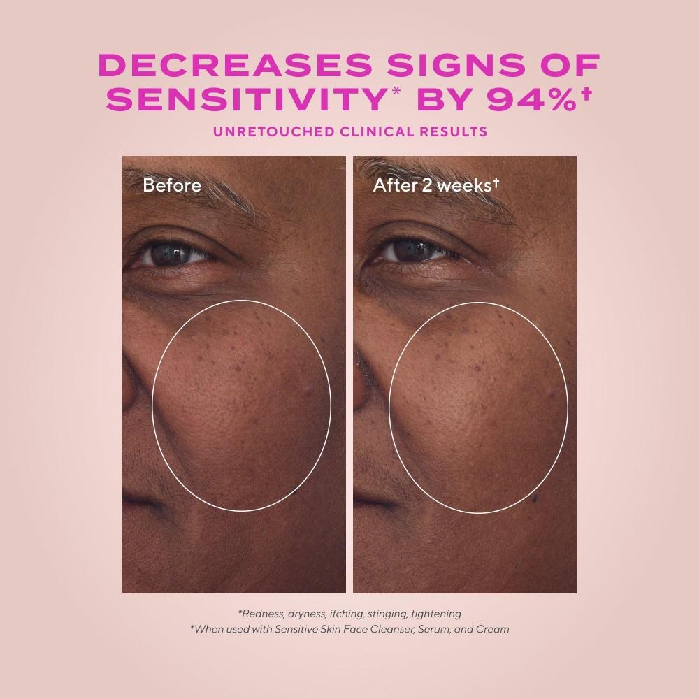 Murad Heartleaf Calming Cream Moisturizer 1.7 Oz