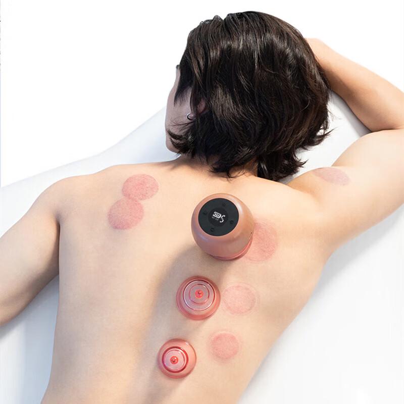 Smart Electric Cupping & Gua Sha Bianstone Massager CN plug (adapter included)