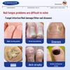 ELSIEDOCTOR Fungus Nail Treatment Solution
