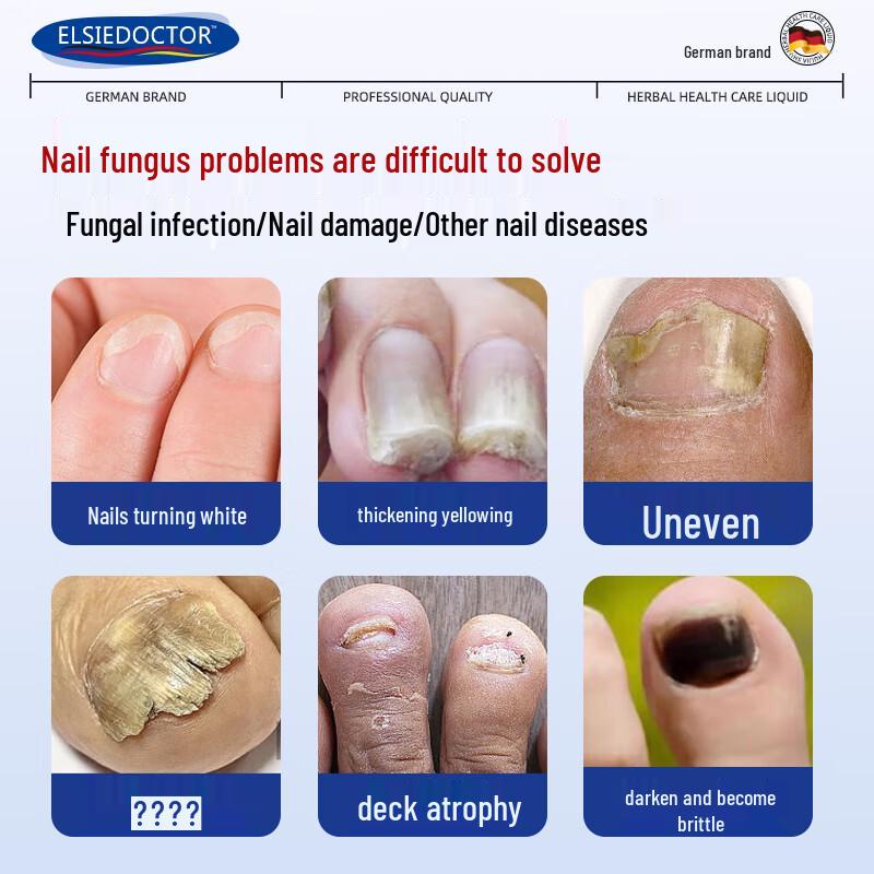 ELSIEDOCTOR Fungus Nail Treatment Solution