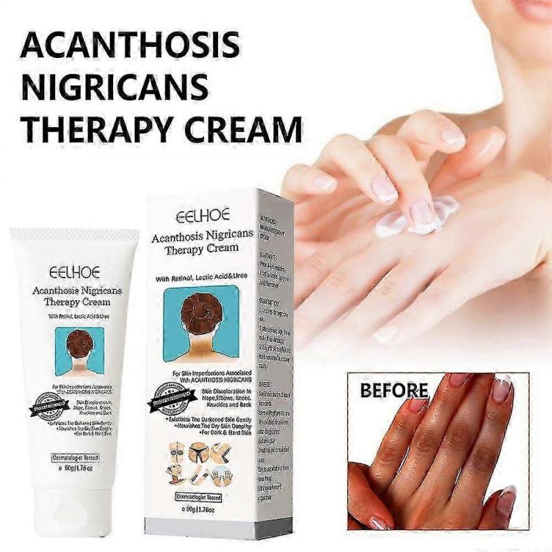 3pcs Acanthosis Cream Nigrifix Cream For Acanthosis Nigricans Black Spot