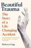 Kniha Beautiful Trauma : The Story of a Life-Changing Accident