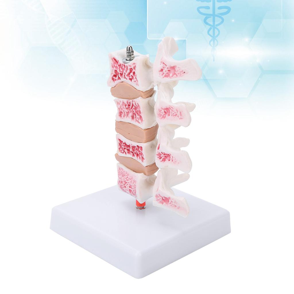 Professional Osteoporosis Model Human Anatomical Spine Model for Teaching Demonstration