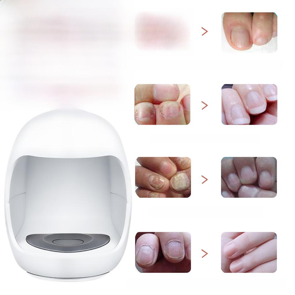 Comprehensive Nail Care Treatment South Moon Targets Yellow Nails Ingrown Nails
