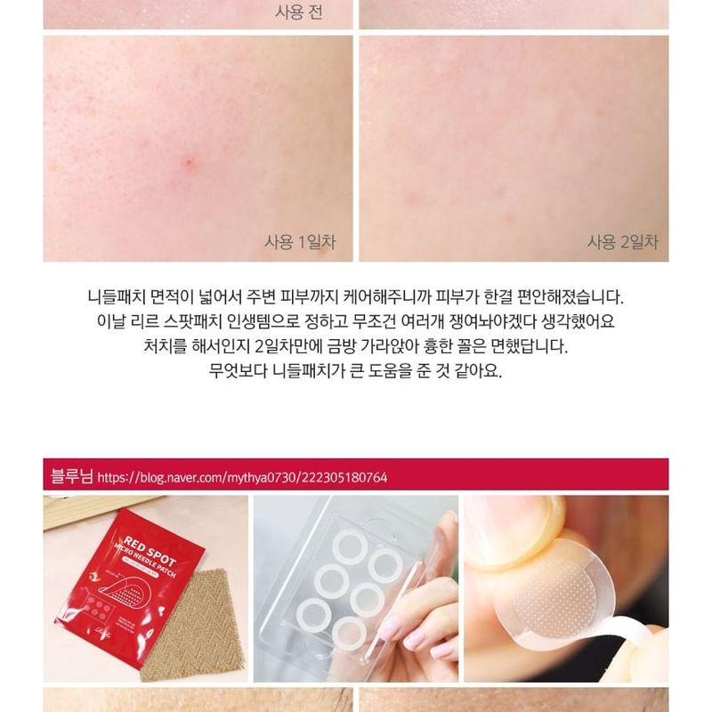 RiRe - Red Spot Micro Needle Patch