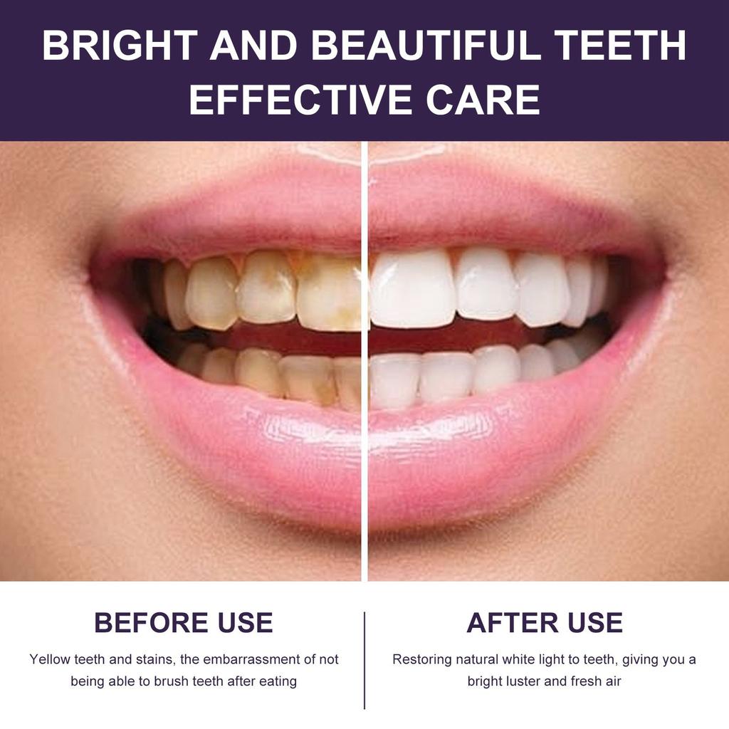 Purple Teeth Whitening Mouthwash Teeth Cleaning Yellow Teeth Stains Whitening Fresh Breath Oral Care 200ML