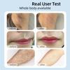 IPL Laser Hair Removal Devicefor Women Unlimited Flashes Permanent Painless Ice Cooling Laser Epilator for Face Whole Body