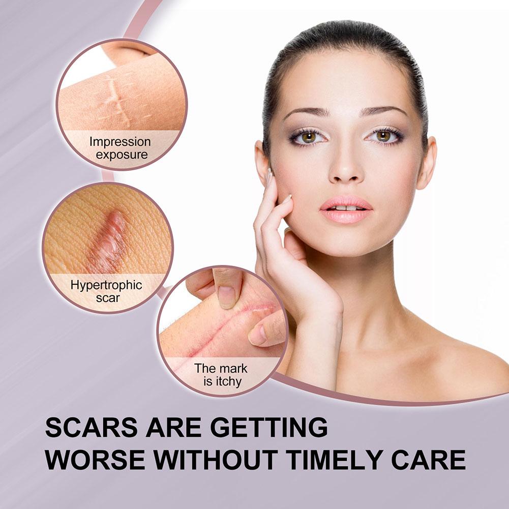 Scar Surgery Scar Dilution Cream To Burn The Impression Scar Dilution Surgery Beard Cream Remov I3U7