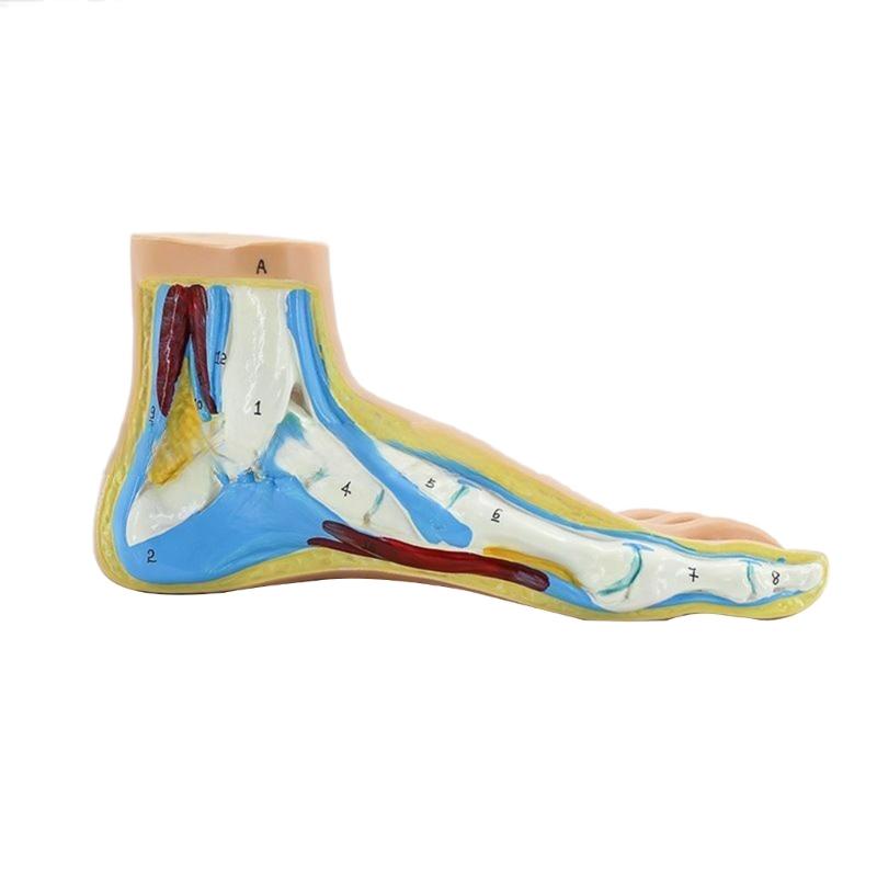 Normal/Flat/High Arched Foot Anatomy Model for Medical Teaching