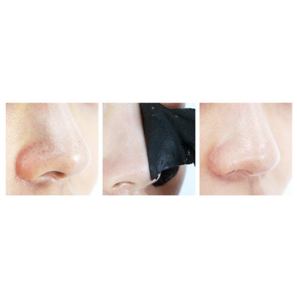 [Lirikos] All Kill Mitesserentferner Nasenmasken-Packung 40ml