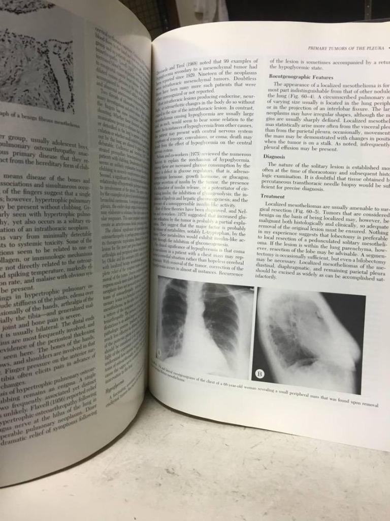 [USED] Hospital disposal book: General Thoracic Surgery medical book in English