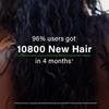 OZiva Hair Vitamin Capsules for Hair Growth & Hair Fall Control,100% Natural with Biotin, Iron,Clinically Proven Hair Growth Supplements