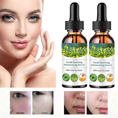 Removing Dark Spot Whitening Cream, Freckles Face Cream, Remove Melasma Remove Dark Spots Cream, Lightening  Remover Brightening Cream