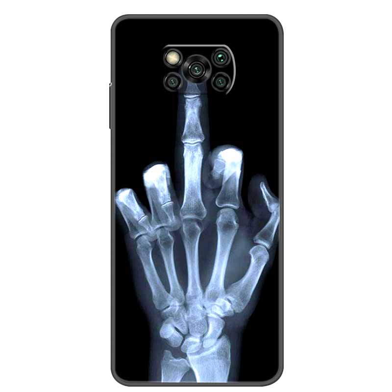 Case For POCO X3 Pro Soft Silicone TPU Black Bumper Cover For Xiaomi Poco X3 NFC Phone Back Cases PocoX3 X 3 X3Pro Cat Cartoon