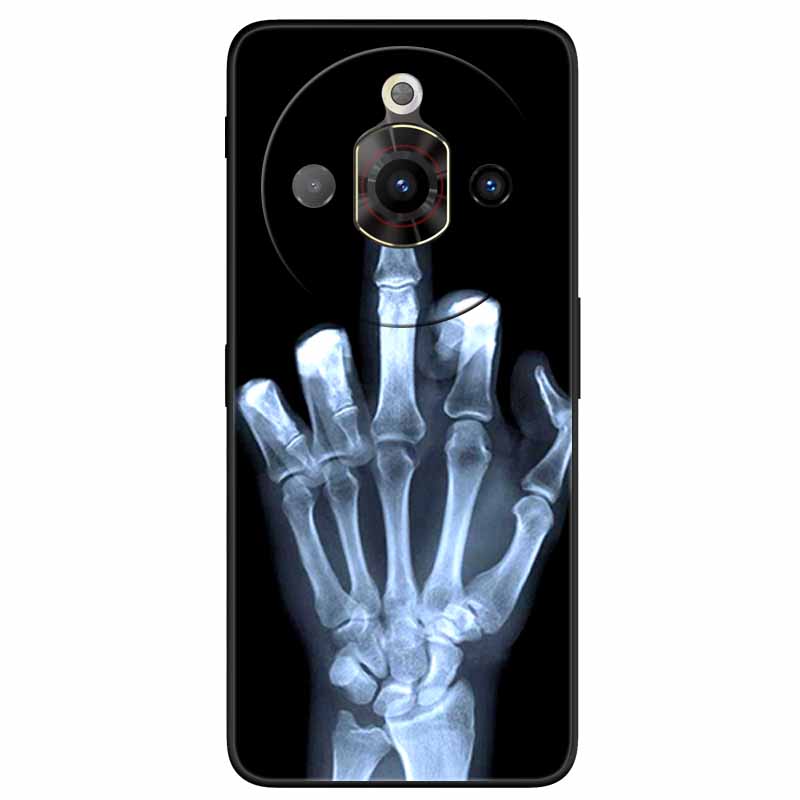 

For ZTE Nubia Focus Pro 5G Case Black TPU Bumper Soft Silicone Phone Cases for ZTE Z2351N Nubia Focus Pro Protective Back Shells Nubia Focus Pro