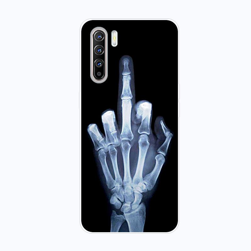 For OPPO Find X2 Neo Case Shockproof Soft silicone TPU Back Cover For OPPO FindX2 Neo Phone Cases Find X2 Lite Case Cute Cartoon