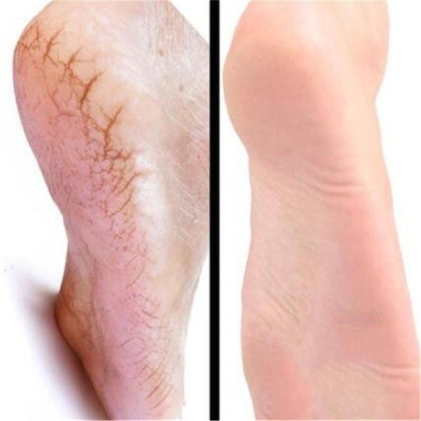 1 Box Horse Oil Hand And Foot Repair Cream Skin Moisturizing Foot Skin Care