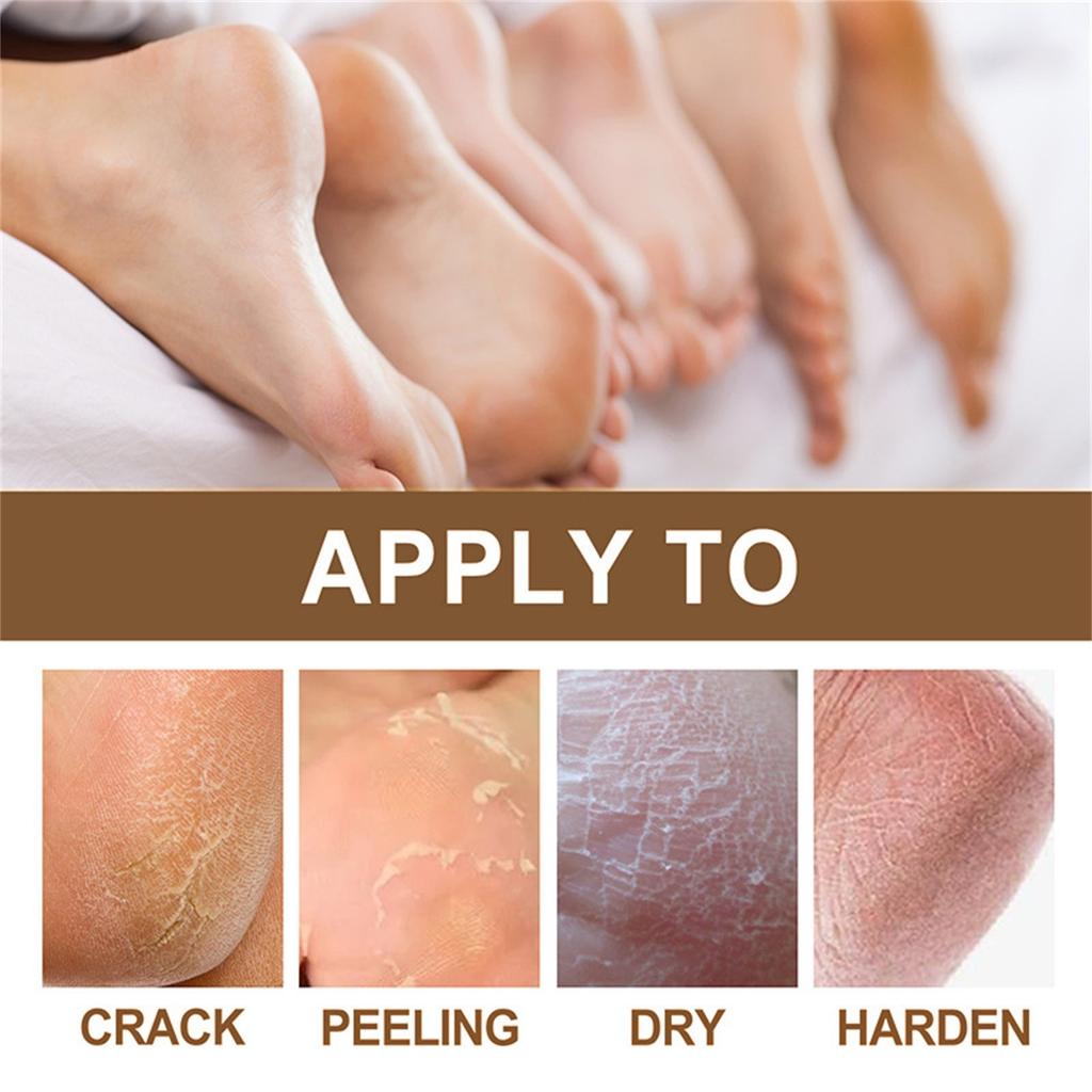 Retinol Hand & Foot Cream, Deep Moisturizing & Beeswax For Soft, Smooth Skin - Hypoallergenic