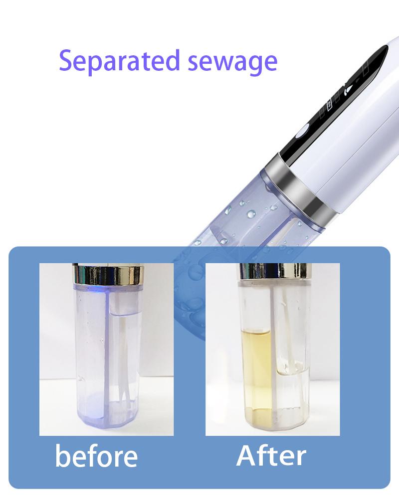 USB Rechargeable Blackhead Extractor – Long-Lasting & Portable Pore Vacuum for Flawless Skin, Easy Facial Cleansing & Pimple Removal