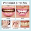 Oralhoe Teeth Stain Remover 15ml Cleans Stains and Plaque, Protects Teeth, and Whitens Teeth.