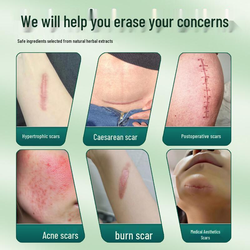 Scar Repair Gel