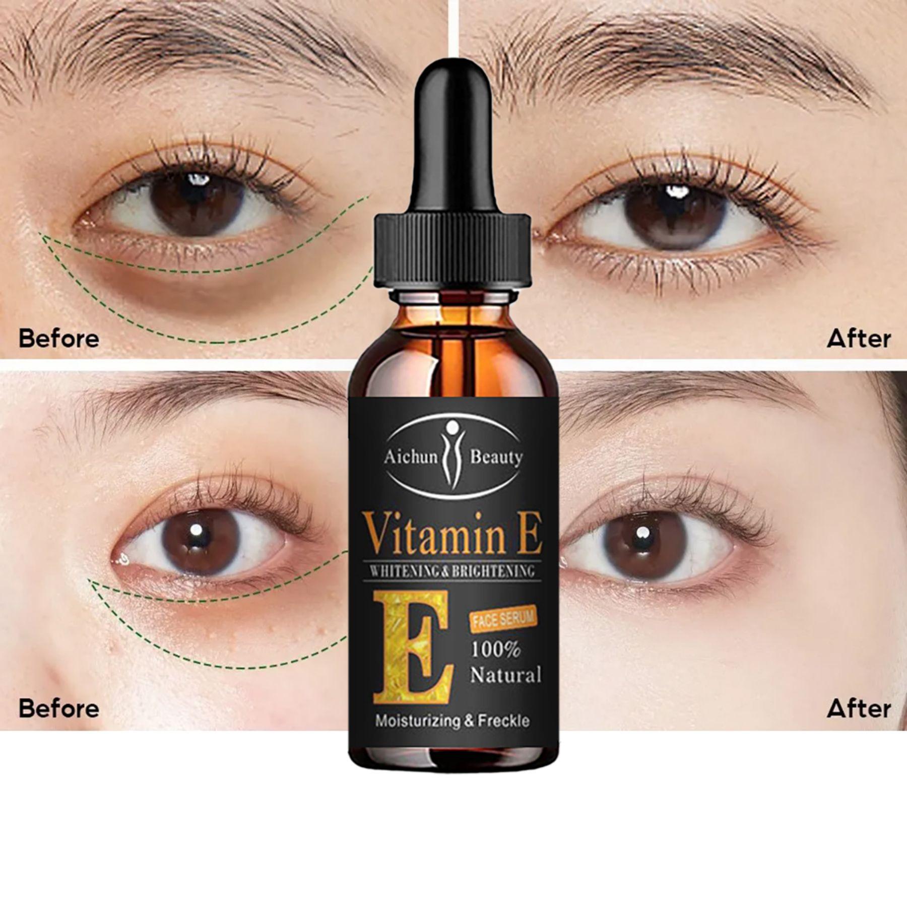 

Новейший укрепляющий крем для глаз может устранить темные круги и жировые частицы под глазами, разгладить морщины и укрепить кожу.