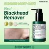 SOME BY MI Bye Bye Black Head 30 Days Miracle Green Tea Tox Bubble Cleanser 120 г