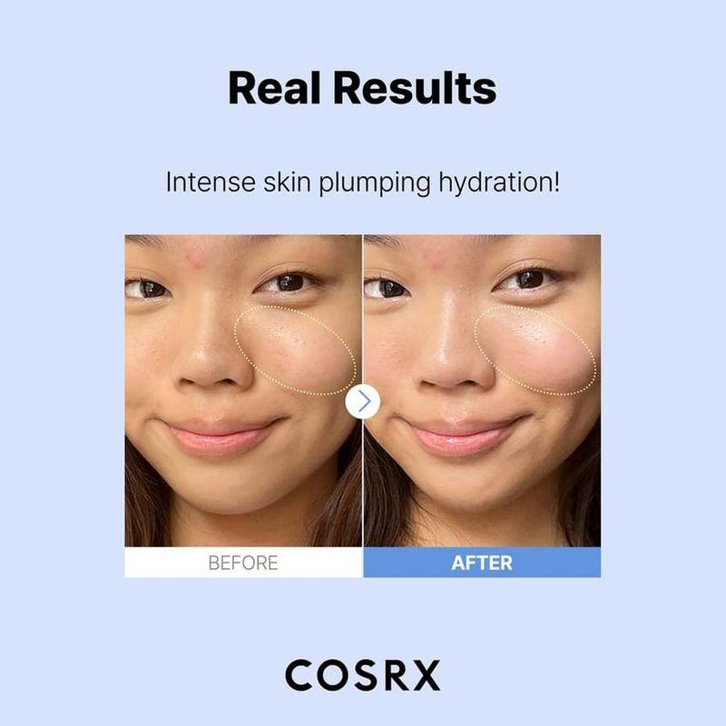 COSRX The Hyaluronic Acid 3 Serum