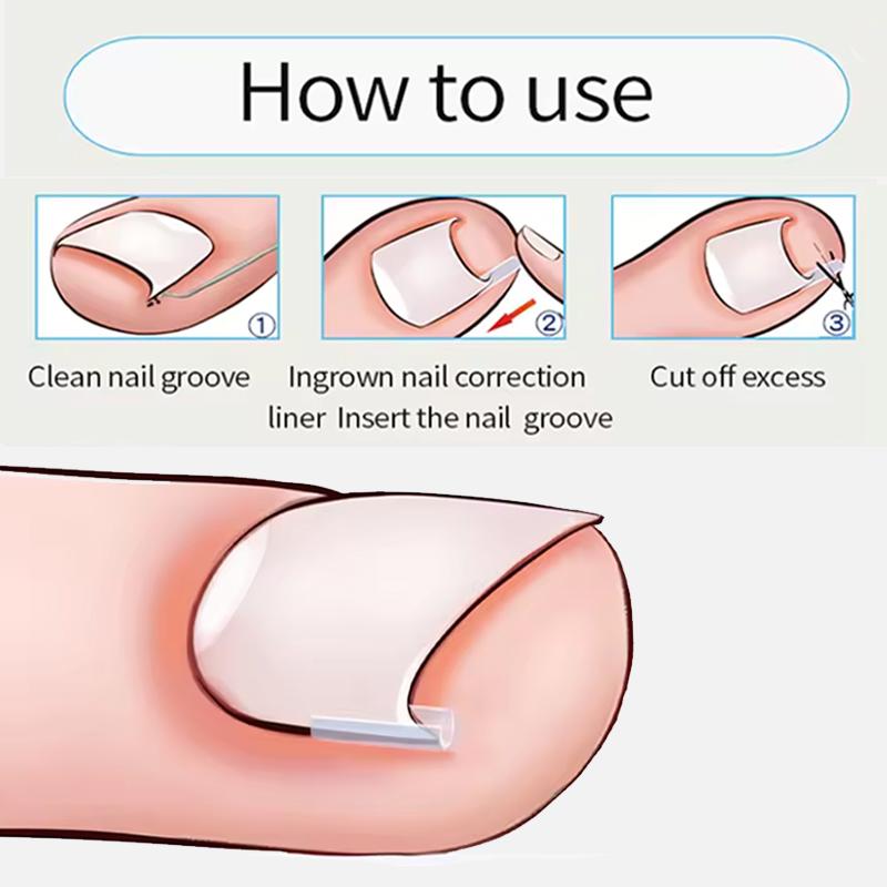 Ingrown Toenail Correction Tool Elastic Patch Nail Filling Pad Toe Straightening Clip Brace Ingrown Nails Pedicure Treatment