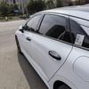 ABS Glossy Black Exterior Door Handle Cover Trim For Kia K5 Accessories     2024 2025 With Smart Keyhole (Not For Optima 2015-)