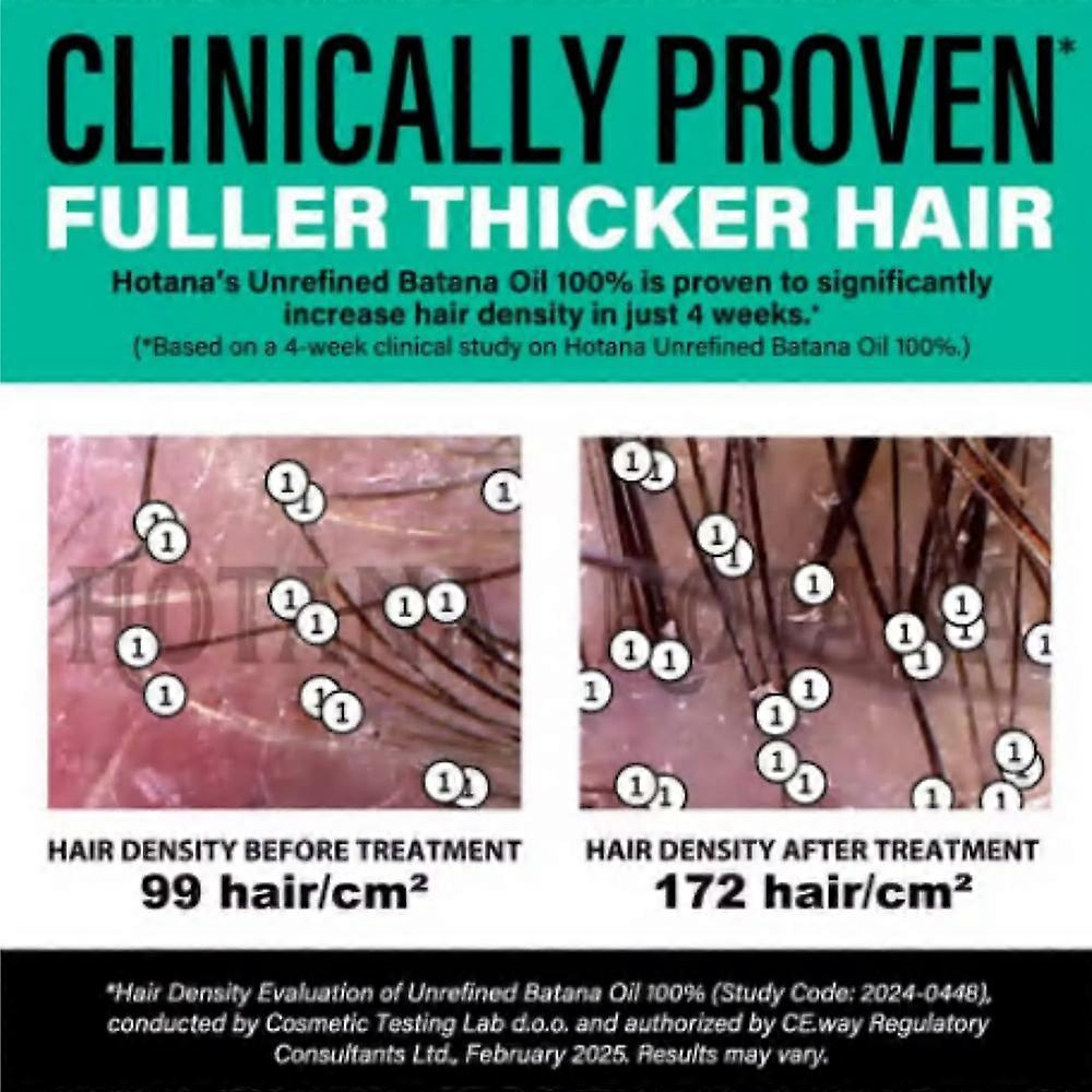 Unraffiniertes Batana-Öl für Haarwachstum - Authentische & Bio Dr. Sebi Batana Haarmaske aus Honduras - Natürliches Haaröl