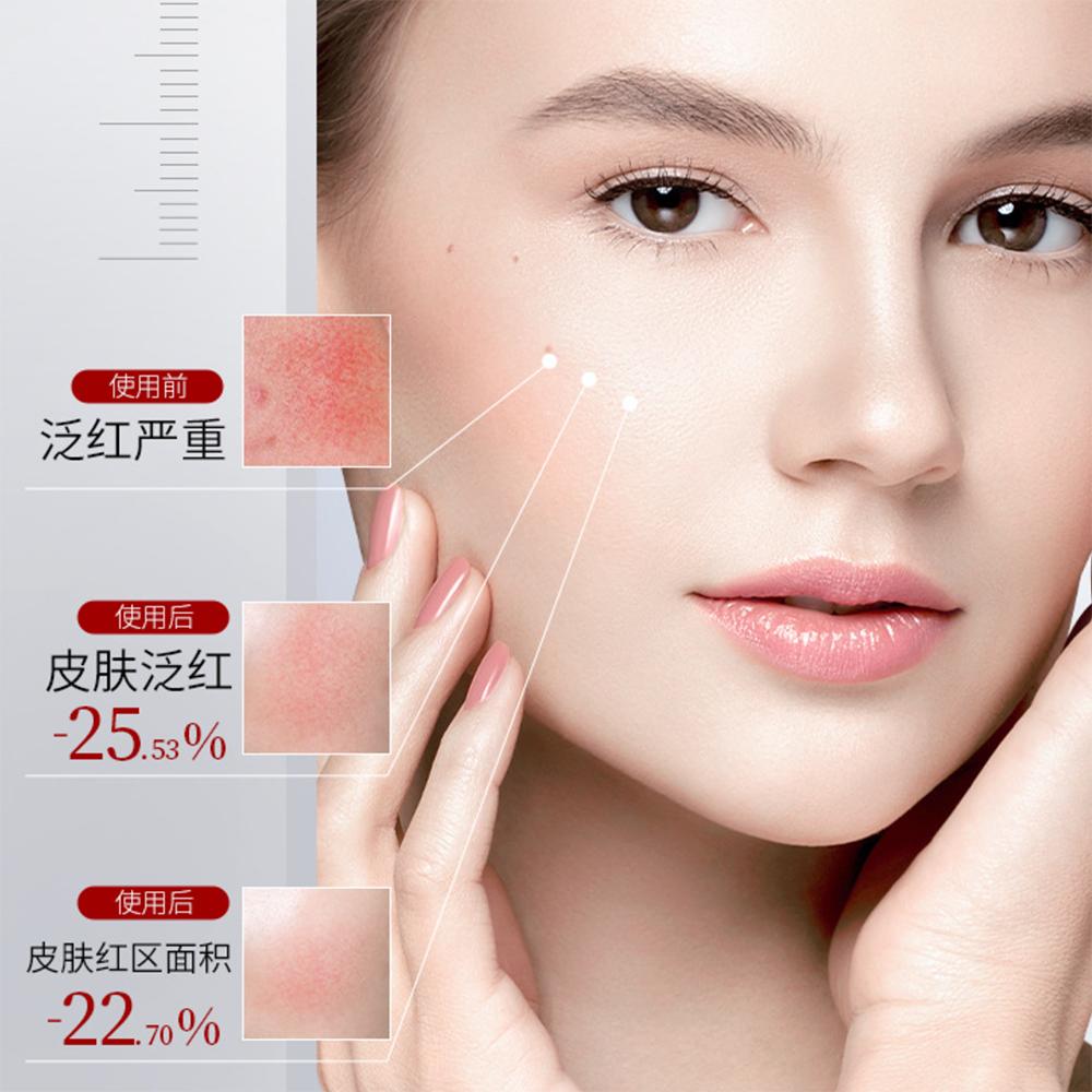 Sensitive Muscle Repair Barrier Soothing Essence Facial Care Moisturizing Hydrating Face Serum Oil Control Serum Korean Skincare