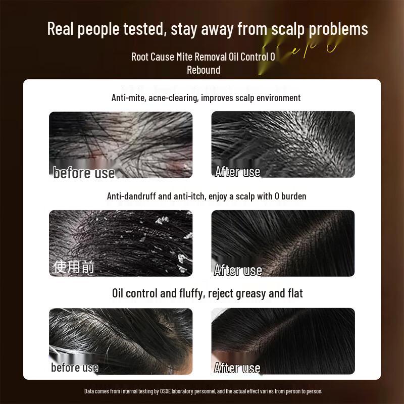 OSXE Follicle Cleansing Anti-Dandruff & Oil Control Shampoo