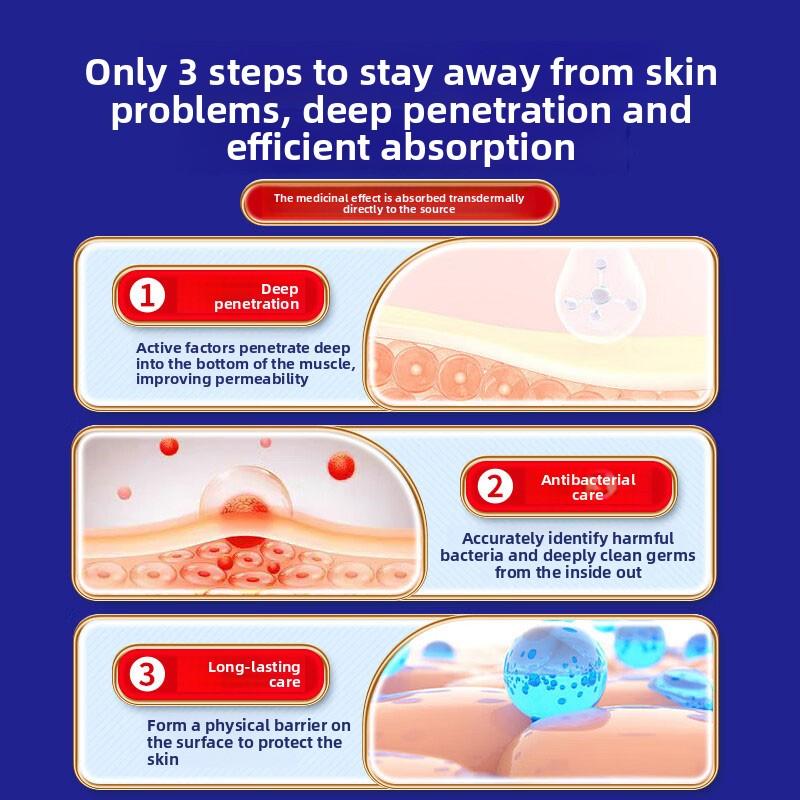 Полностью натуральный крем от дерматита - Успокаивает зудящую кожу, Мягкий для чувствительных типов, Облегчает экзему