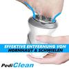PediClean Electric Callus Remover Callus Rasp Rechargeable White
