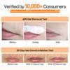 1/2Pcs 20G Facial Hair Removal Cream Gentle Pain Free Fast Acting Moisturizing Arm Leg Underarms Lip Hair Remover Depilatory Cream