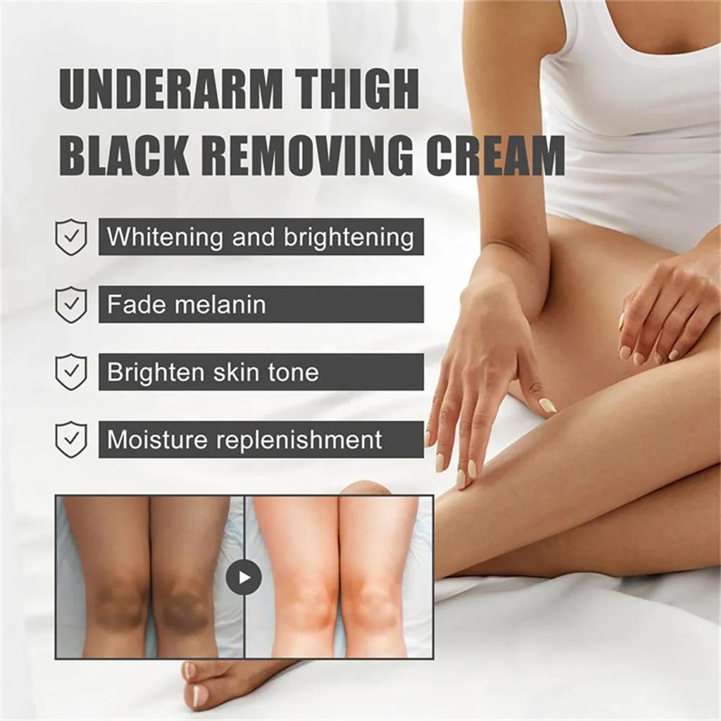 Anti Black Knee and Elbow Glow Cream Removes Dullness, Brightens Skin Tone, Moisturizes and Moisturizes