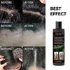EELHOE Anti-tinea and Anti-itching Shampoo, Anti-hair Loss, Refreshing, Oil-controlling, Anti-dandruff and Anti-itching Shampoo