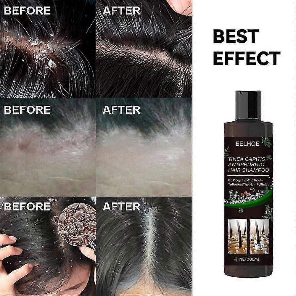 EELHOE Anti-tinea and Anti-itching Shampoo, Anti-hair Loss, Refreshing, Oil-controlling, Anti-dandruff and Anti-itching Shampoo