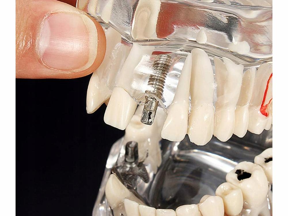 Dental Model 2 White (100) Gab_B