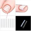 Ingrown Toenail Correction Tool Elastic Patch Nail Filling Pad Toe Straightening Clip Brace Ingrown Nails Pedicure Treatment