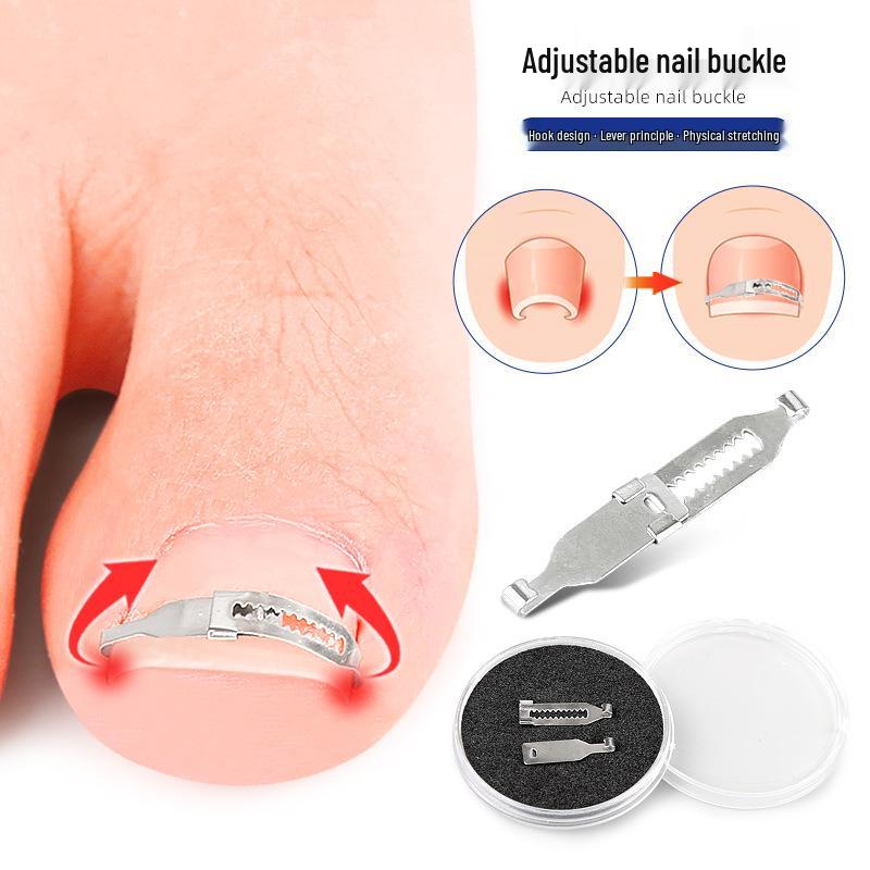 Ingrown Toenail Orthotic Patch & Foot Care Tool for Curled Nails and Nail Groove Ingrowth