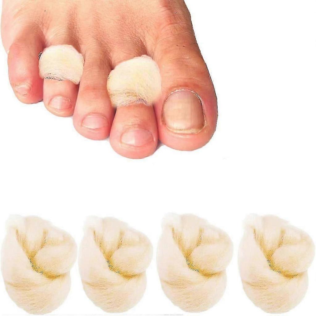 4 Bags Lambs Wool Toe Splint Cushions for Toes, Soft Feet Lams Wool Toe
