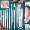 10-Piece Stainless Steel Nail Inlay and Dead Skin Removal Tool Set - Unscented Pedicure Nail Set, Halloween Gift