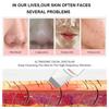 Ultrasonic Skin Scrubber Vibration Face Spatula Blackhead Remover Shovel Clean Cavitation Peeling Facial Lifting Skin Care Tools