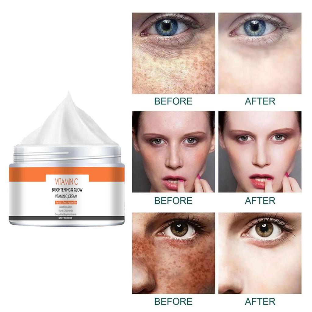 Face Cream Dehydrates, Moisturizes and Moisturizes Skin, Reduces Fine Lines and Wrinkles