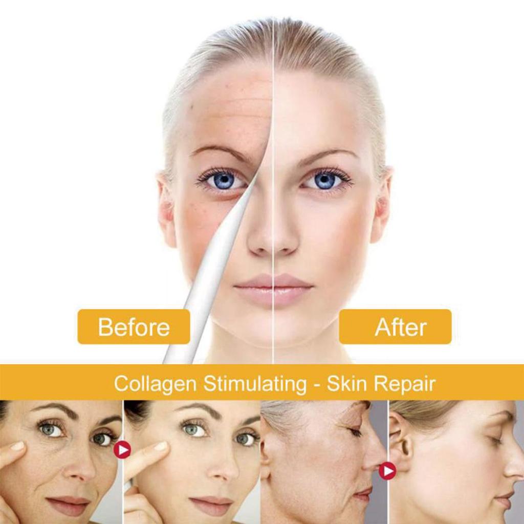 Essence cream to reduce fine lines, smooth wrinkles and improve damaged skin
