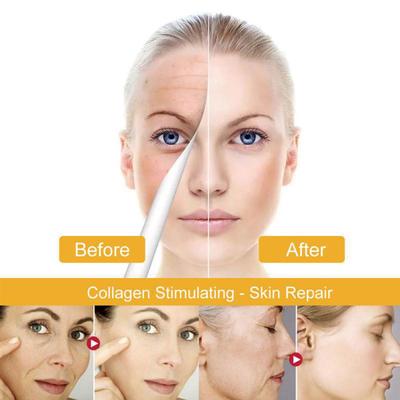 Essence-Creme zur Reduzierung feiner Linien, Glättung von Fältchen und Verbesserung geschädigter Haut