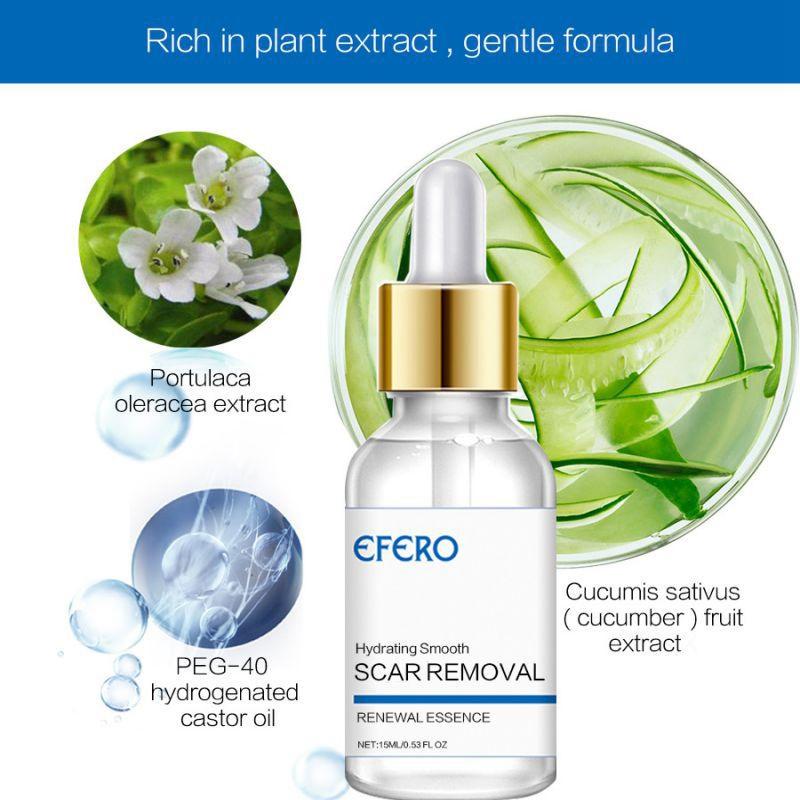 Buy Scar Removal Liquid Acne Mark Stretch Marks Scar Repair Liquid at