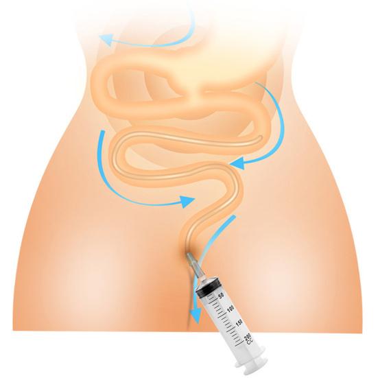 150/200//250/300/350/500ML Easy Insertion Anal Flusher Precise Scale Effortless Feces Drainage Anal Flusher